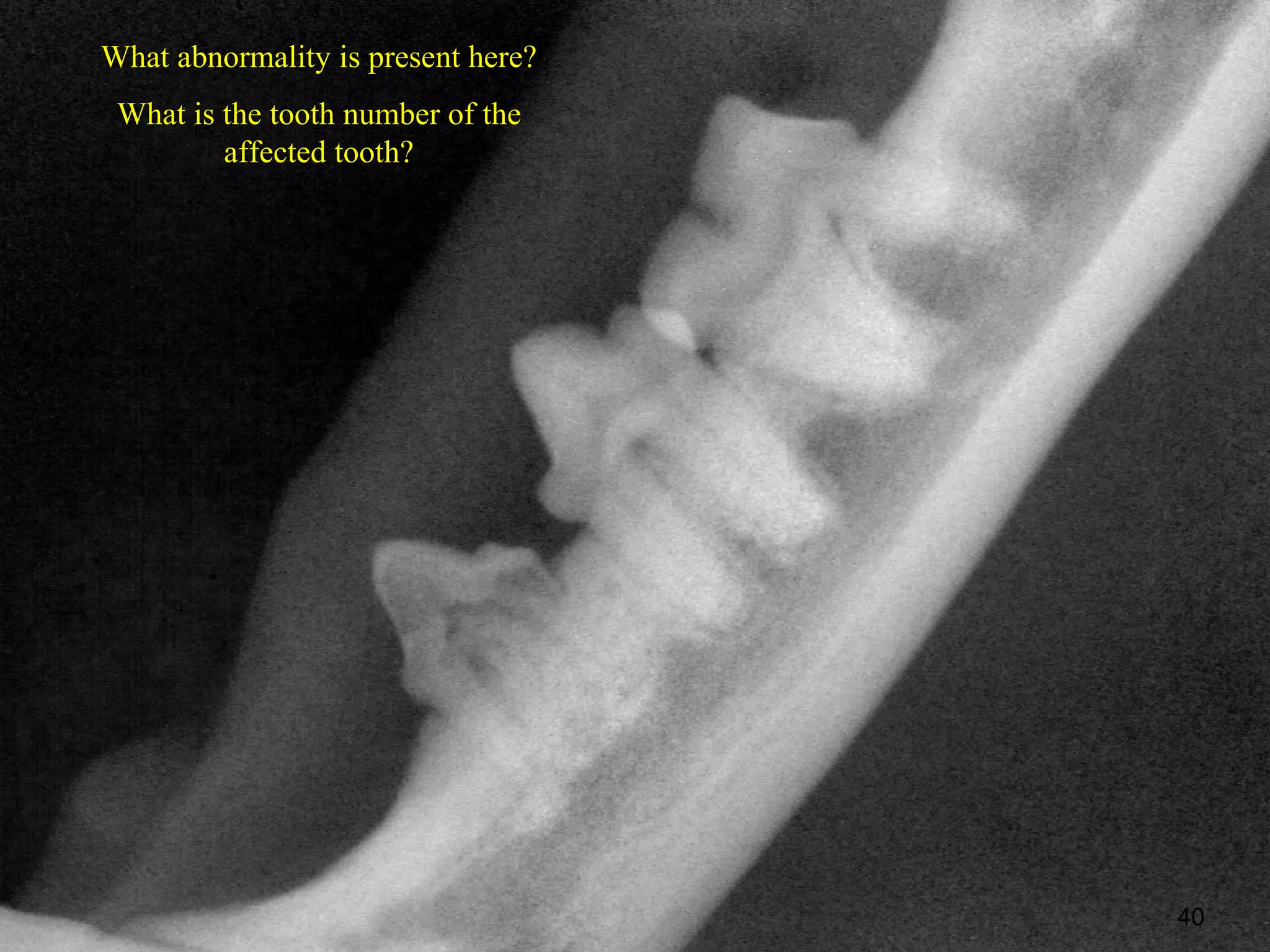 What abnormality is present here?
 What is the tooth number of the
         affected tooth?




                                    40
 