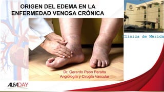 Dr. Gerardo Peón Peralta
Angiología y Cirugía Vascular
ORIGEN DEL EDEMA EN LA
ENFERMEDAD VENOSA CRÓNICA
 