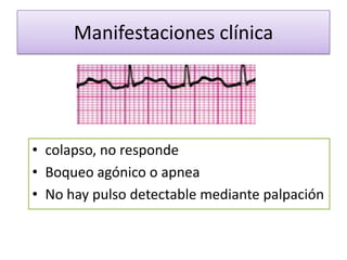 Manifestaciones clínica




• colapso, no responde
• Boqueo agónico o apnea
• No hay pulso detectable mediante palpación
 