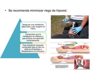 • Se recomienda minimizar riego de hipoxia:



            Asegurar una ventilación
           adecuada y con oxígeno al
                    100%.

              Comprobar que la
            ventilación es bilateral y
           que el tórax se expanden
                correctamente.

            Tras intubación traqueal,
           comprobar que el tubo no
              está en el esófago o
           Desplazado a un bronquio.
 