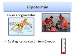 • En los ahogamientos.




• Se diagnostica con un termómetro.
 