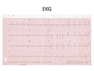 EKG
 