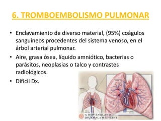6. TROMBOEMBOLISMO PULMONAR
• Enclavamiento de diverso material, (95%) coágulos
  sanguíneos procedentes del sistema venoso, en el
  árbol arterial pulmonar.
• Aire, grasa ósea, líquido amniótico, bacterias o
  parásitos, neoplasias o talco y contrastes
  radiológicos.
• Dificil Dx.
 