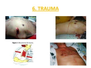 6. TRAUMA
 