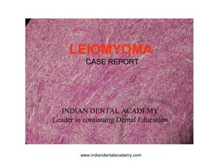 LEIOMYOMA
CASE REPORT
INDIAN DENTAL ACADEMY
Leader in continuing Dental Education
www.indiandentalacademy.com
 