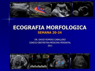 ECOGRAFIA MORFOLOGICA SEMANA 20-24 DR. DAVID ROMERO CABALLERO GINECO-OBSTRETRA-MEDICINA PERINATAL 2011 