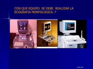 DTFRC-2007 CON QUE EQUIPO  SE DEBE  REALIZAR LA ECOGRAFIA MORFOLOGICA .? 