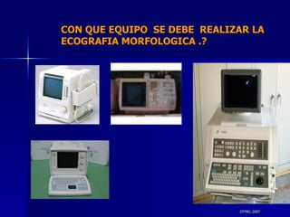 DTFRC-2007 CON QUE EQUIPO  SE DEBE  REALIZAR LA  ECOGRAFIA MORFOLOGICA .? 