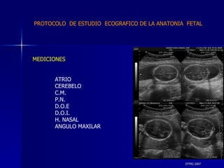 DTFRC-2007 MEDICIONES ATRIO CEREBELO C.M. P.N. D.O.E D.O.I. H. NASAL ANGULO MAXILAR PROTOCOLO  DE ESTUDIO  ECOGRAFICO DE LA ANATONIA  FETAL 
