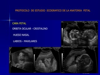 DTFRC-2007 CARA FETAL  ORBITA OCULAR - CRISTALINO  HUESO NASAL LABIOS - MAXILARES PROTOCOLO  DE ESTUDIO  ECOGRAFICO DE LA ANATONIA  FETAL 