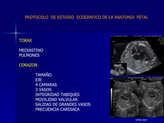 DTFRC-2007 TORAX  MEDIASTINO  PULMONES CORAZON TAMAÑO EJE 4 CAMARAS 3 VASOS INTEGRIDAD TABIQUES MOVILIDAD VALVULAR SALIDAS DE GRANDES VASOS FRECUENCIA CARDIACA PROTOCOLO  DE ESTUDIO  ECOGRAFICO DE LA ANATONIA  FETAL 