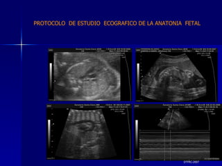DTFRC-2007 PROTOCOLO  DE ESTUDIO  ECOGRAFICO DE LA ANATONIA  FETAL 