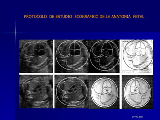 DTFRC-2007 PROTOCOLO  DE ESTUDIO  ECOGRAFICO DE LA ANATONIA  FETAL 