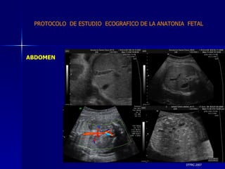 DTFRC-2007 ABDOMEN PROTOCOLO  DE ESTUDIO  ECOGRAFICO DE LA ANATONIA  FETAL 