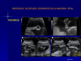 DTFRC-2007 MIEMBROS   PROTOCOLO  DE ESTUDIO  ECOGRAFICO DE LA ANATONIA  FETAL 