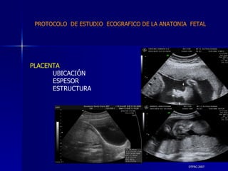 DTFRC-2007 PLACENTA   UBICACIÓN ESPESOR ESTRUCTURA PROTOCOLO  DE ESTUDIO  ECOGRAFICO DE LA ANATONIA  FETAL 