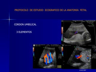 DTFRC-2007 CORDON UMBILICAL 3 ELEMENTOS PROTOCOLO  DE ESTUDIO  ECOGRAFICO DE LA ANATONIA  FETAL 