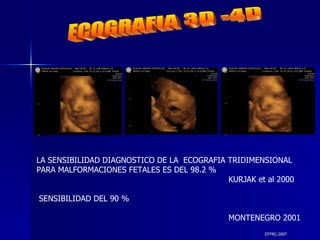 DTFRC-2007 ECOGRAFIA 3D -4D LA SENSIBILIDAD DIAGNOSTICO DE LA  ECOGRAFIA TRIDIMENSIONAL  PARA MALFORMACIONES FETALES ES DEL 98.2 % KURJAK et al 2000 SENSIBILIDAD DEL 90 %  MONTENEGRO 2001 