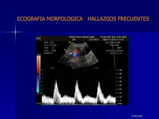 DTFRC-2007 ECOGRAFIA MORFOLOGICA  HALLAZGOS FRECUENTES   