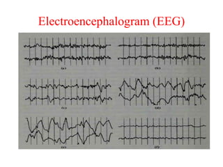 Electroencephalogram (EEG)
 