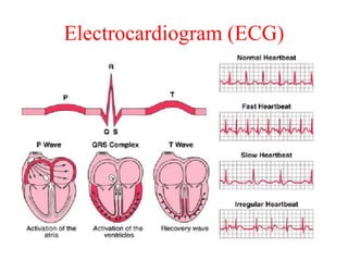 Electrocardiogram (ECG)
 