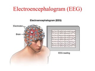 Electroencephalogram (EEG)
 