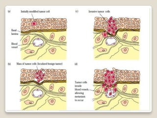 Origin of cancer and terminology.pptxaaa | PPTX