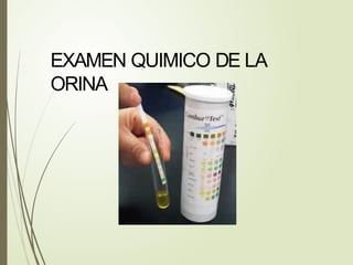 EXAMEN QUIMICO DE LA
ORINA
 