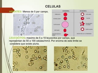CELULAS
HEMATÍES: Menos de 5 por campo.
LEUCOCITOS: maximo de 5 a 10 leucocitos por campo, que
representan de 50 a 100 celulas/mm3. Por encima de este limite se
considera que existe piuria.
 