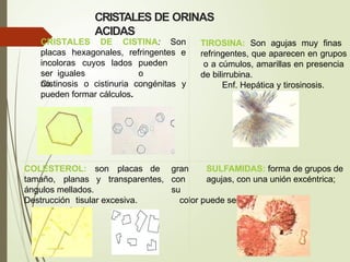 CRISTALES DE CISTINA: Son
placas hexagonales, refringentes e
incoloras cuyos lados pueden
ser iguales o
no.
Cistinosis o cistinuria congénitas y
pueden formar cálculos.
CRISTALES DE ORINAS
ACIDAS
TIROSINA: Son agujas muy finas
refringentes, que aparecen en grupos
o a cúmulos, amarillas en presencia
de bilirrubina.
Enf. Hepática y tirosinosis.
son placas
COLESTEROL:
tamaño, planas y transparentes,
ángulos mellados.
Destrucción tisular excesiva.
de gran SULFAMIDAS: forma de grupos de
con agujas, con una unión excéntrica;
su
color puede ser claro o castaño
 