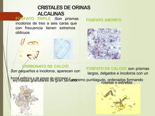 CRISTALES DE ORINAS
ALCALINAS
FOSFATO TRIPLE :Son prismas
incoloros de tres a seis caras que
con frecuencia tienen extremos
oblicuos
FOSFATO AMORFO
CARBONATO DE CALCIO
Son pequeños e incoloros, aparecen con
en masas granulares de gran tamaño.
FOSFATO DE CALCIO: son prismas
largos, delgados e incoloros con un
forma esférica o de pesas de gimnasia o
extremo puntiagudo, ordenados formando
rosetas o estrellas .
 