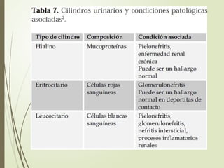 Examen general de orina y sus componentes