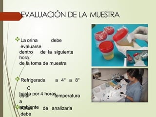 EVALUACIÓN DE LA MUESTRA
La orina debe
evaluarse
dentro de la siguiente
hora
de la toma de muestra
Refrigerada a 4° a 8°
C
hasta por 4 horas
Antes de analizarla
debe
temperatura
estar
a
ambiente
 