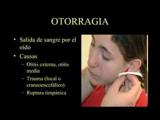 OTORRAGIA Salida de sangre por el oído Causas Otitis externa, otitis media Trauma (local o craneoencefálico) Ruptura timpánica 