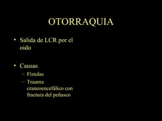 OTORRAQUIA Salida de LCR por el oido Causas Fístulas Trauma craneoencefálico con fractura del peñasco 
