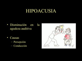HIPOACUSIA Disminución en la agudeza auditiva Causas Persepción Conducción 