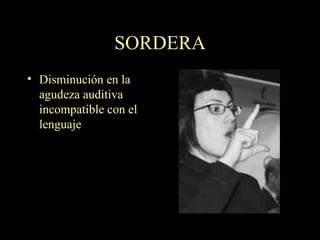 SORDERA Disminución en la agudeza auditiva incompatible con el lenguaje 