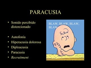 PARACUSIA Sonido percibido distorcionado Autofonía Hiperacusia dolorosa Diploacusia Paracusia Recruitment BLAW, BLAW, BLAW, BLAW 