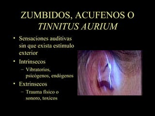 ZUMBIDOS , ACUFENOS O  TINNITUS AURIUM Sensaciones auditivas sin que exista estímulo exterior Intrinsecos Vibratorios, psicógenos, endógenos Extrinsecos Trauma físico o sonoro, toxicos 