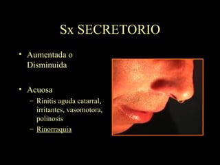 Sx SECRETORIO Aumentada o Disminuida Acuosa Rinitis aguda catarral, irritantes, vasomotora, polinosis Rinorraquia 