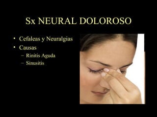 Sx NEURAL DOLOROSO Cefaleas y Neuralgias Causas Rinitis Aguda Sinusitis 