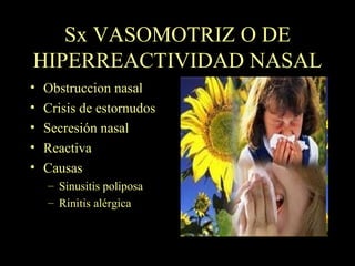 Sx VASOMOTRIZ O DE HIPERREACTIVIDAD NASAL Obstruccion nasal Crisis de estornudos Secresión nasal Reactiva Causas Sinusitis poliposa Rinitis alérgica 
