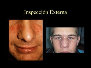 Inspección Externa 