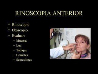 RINOSCOPIA ANTERIOR Rinoscopio Otoscopio Evaluar: Mucosa Luz Tabique Cornetes Secresiones 