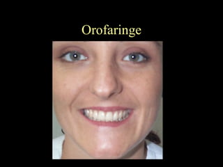 Orofaringe 
