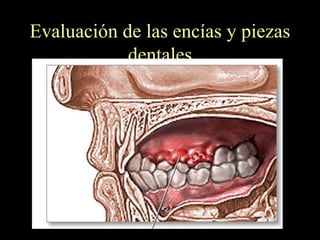 Evaluación de las encías y piezas dentales 
