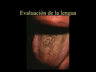 Evaluación de la lengua 