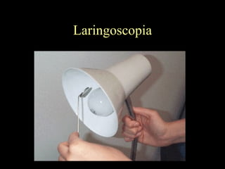 Laringoscopia 