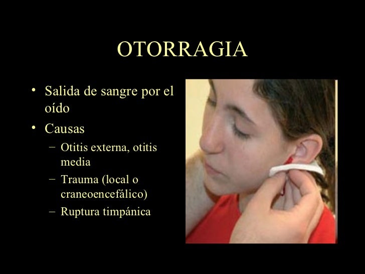 OTORRINOLARINGOLOGIA