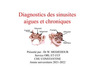 Sinusites chroniques – Dr Lasfargue
